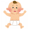 汗疹の赤ちゃん
