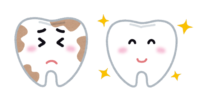 虫歯と綺麗な歯